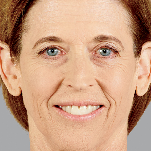 Julia After Voluma