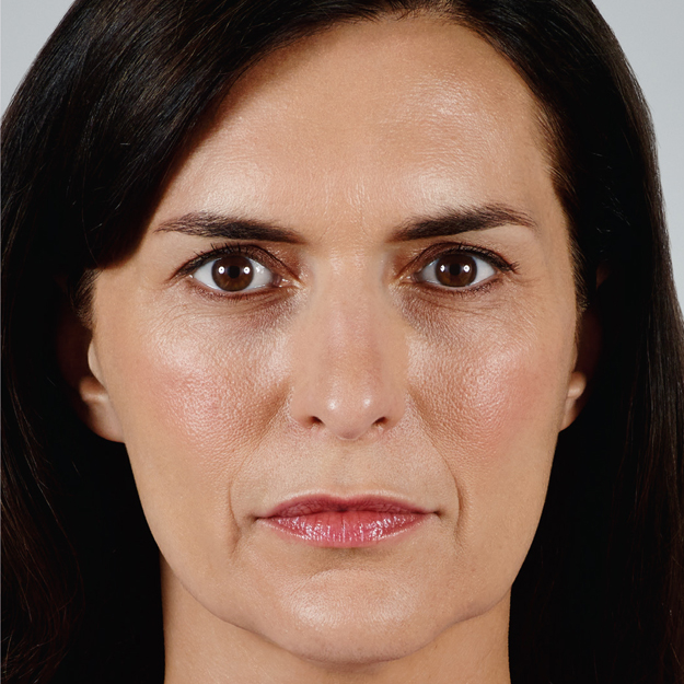 Catherine Before Vollure