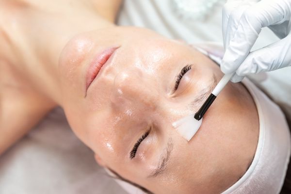 specialist applying peeling acid to woman's face
